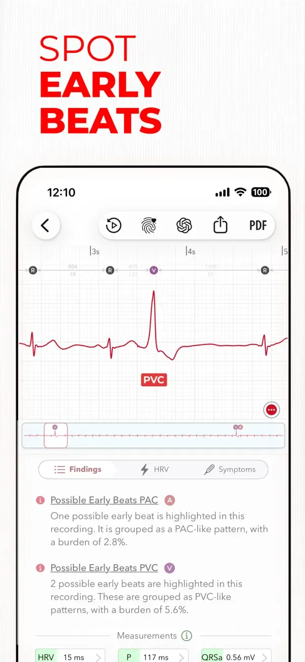 ECG+ | Interpretación de ECG screenshot 1