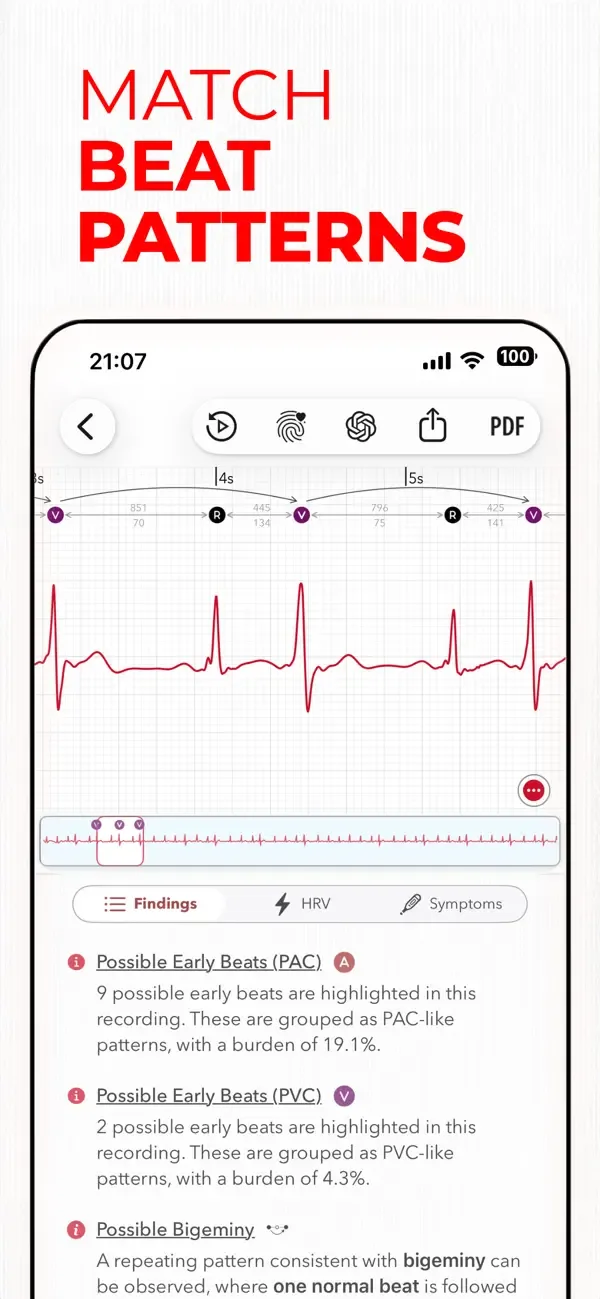 ECG+ | Interpretación de ECG screenshot 3