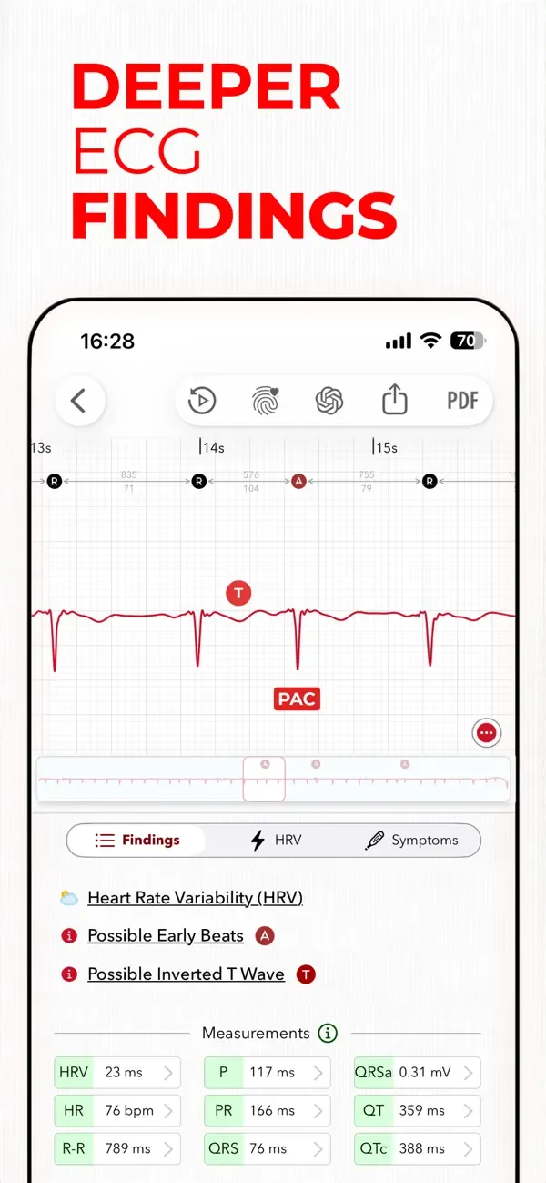 ECG+ | Interpretación de ECG screenshot 5