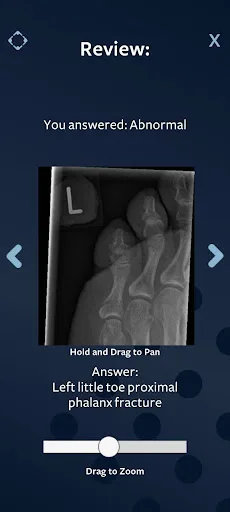 Revise Radiology screenshot 5
