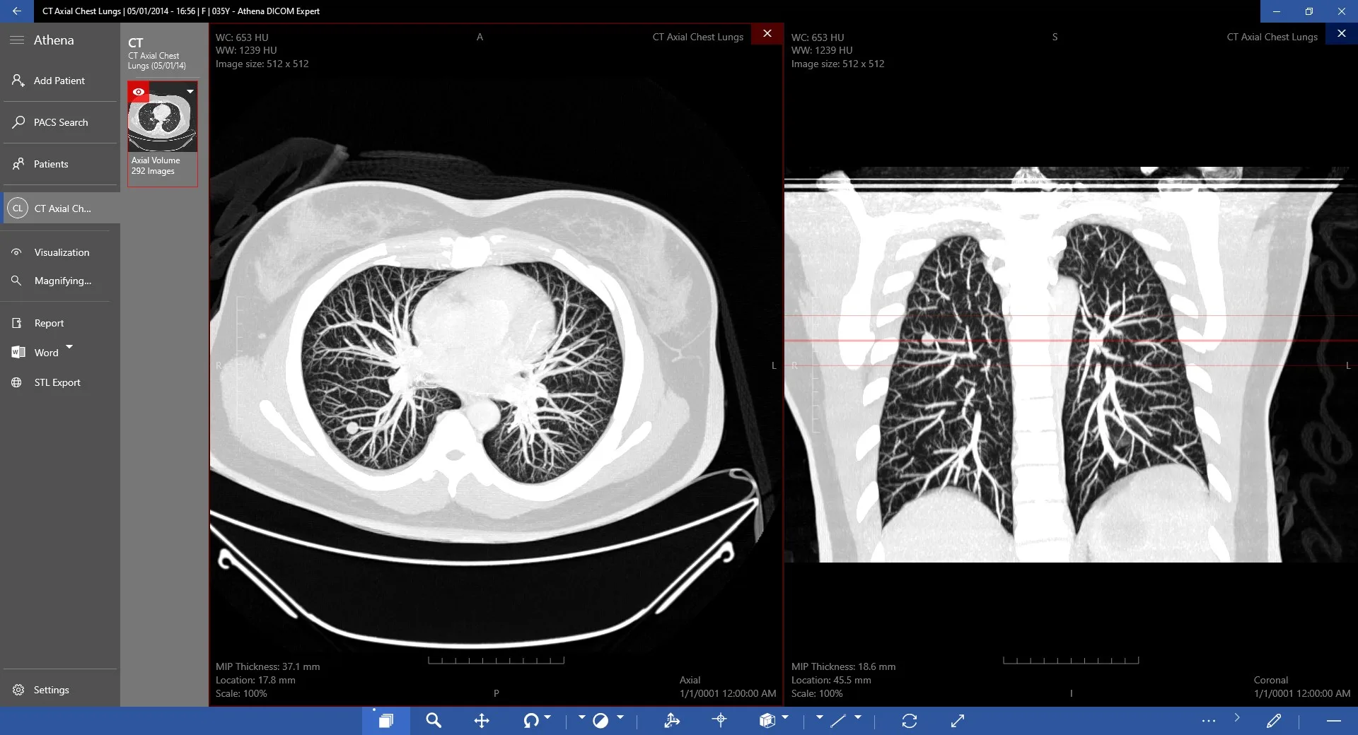 DICOM Viewer Expert screenshot 1