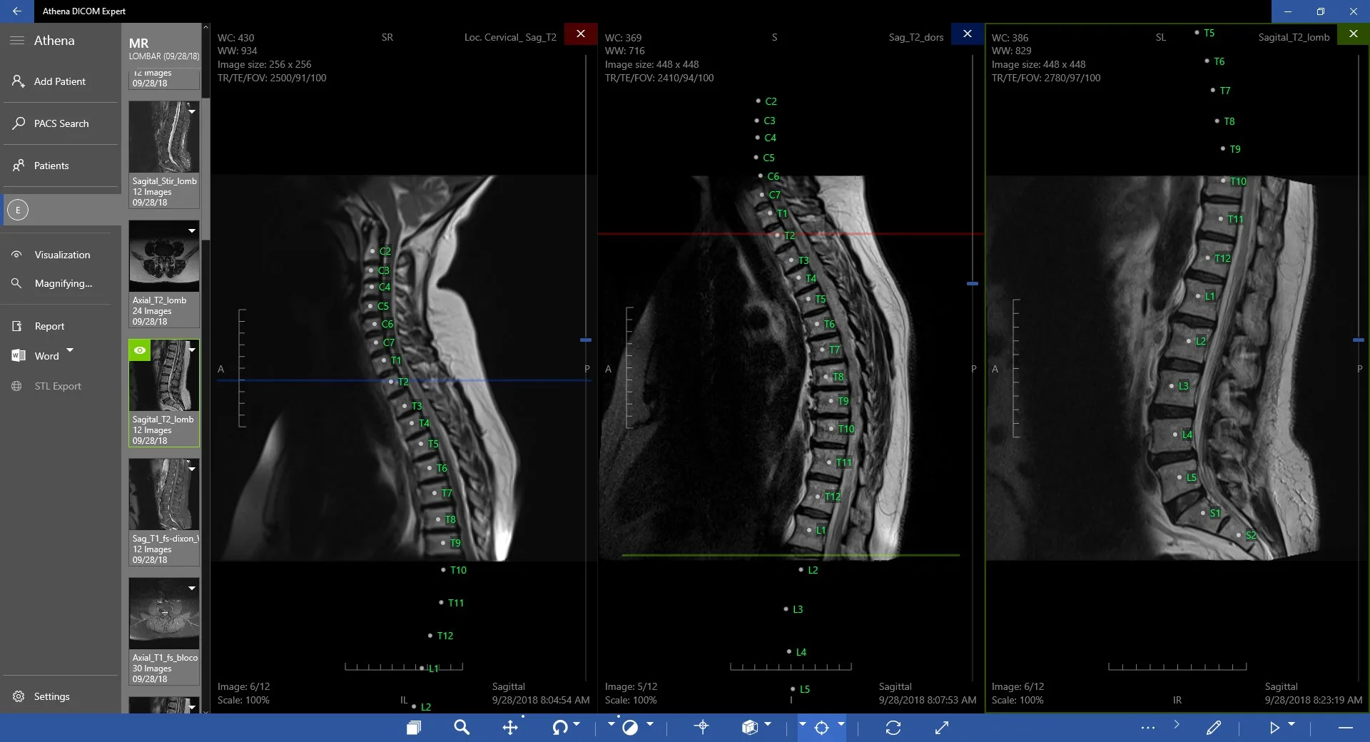 DICOM Viewer Expert screenshot 2