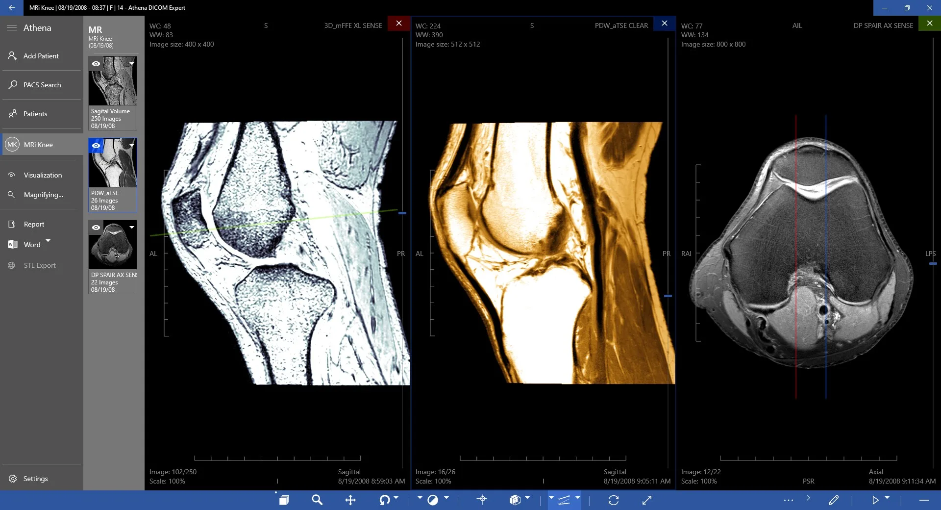 DICOM Viewer Expert screenshot 3