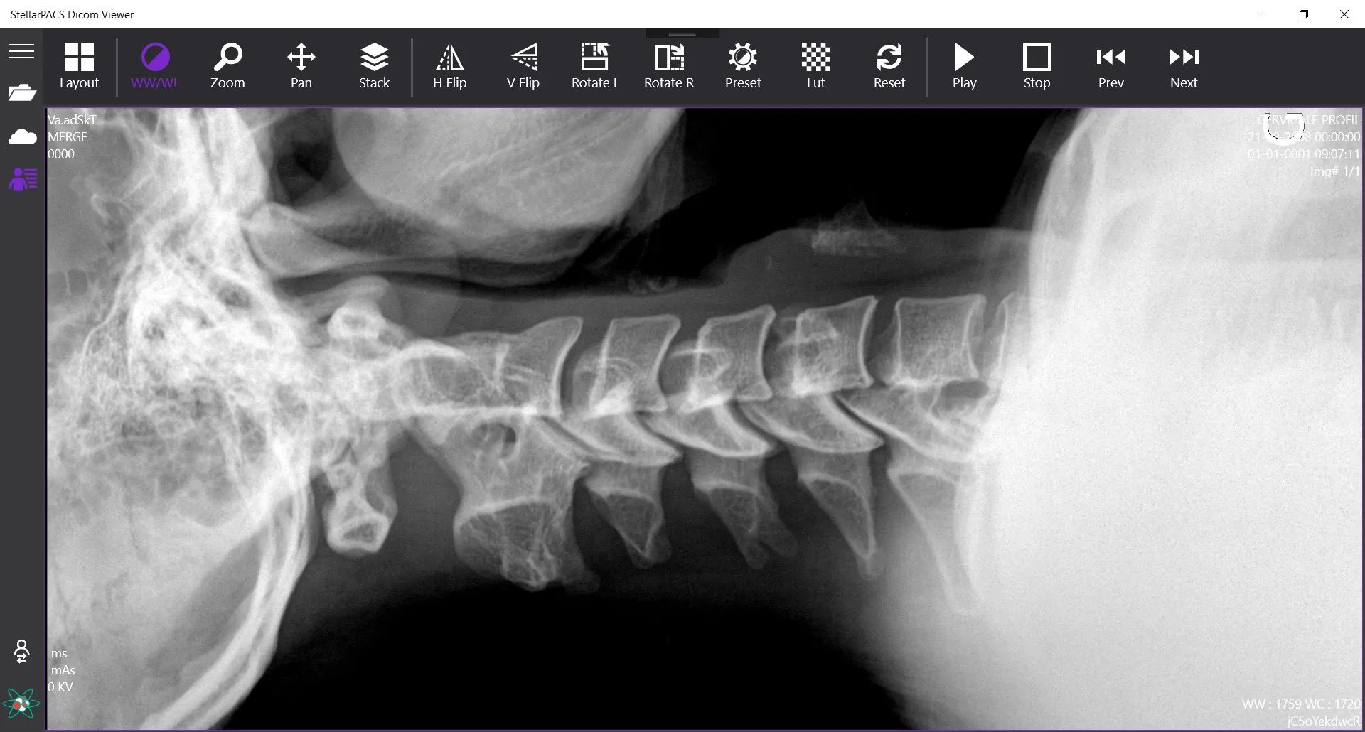 StellarPACS DICOM Viewer screenshot 1