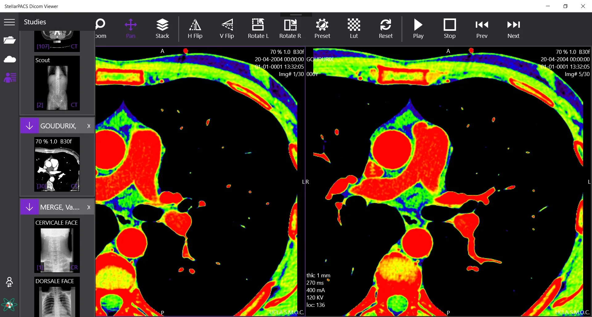 StellarPACS DICOM Viewer screenshot 2