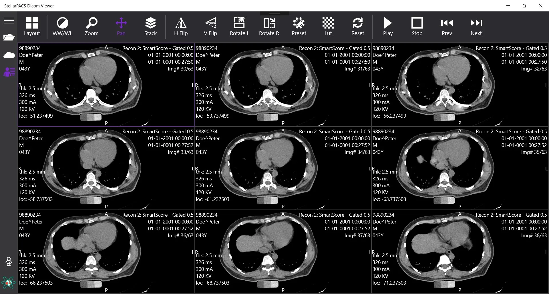 StellarPACS DICOM Viewer screenshot 3