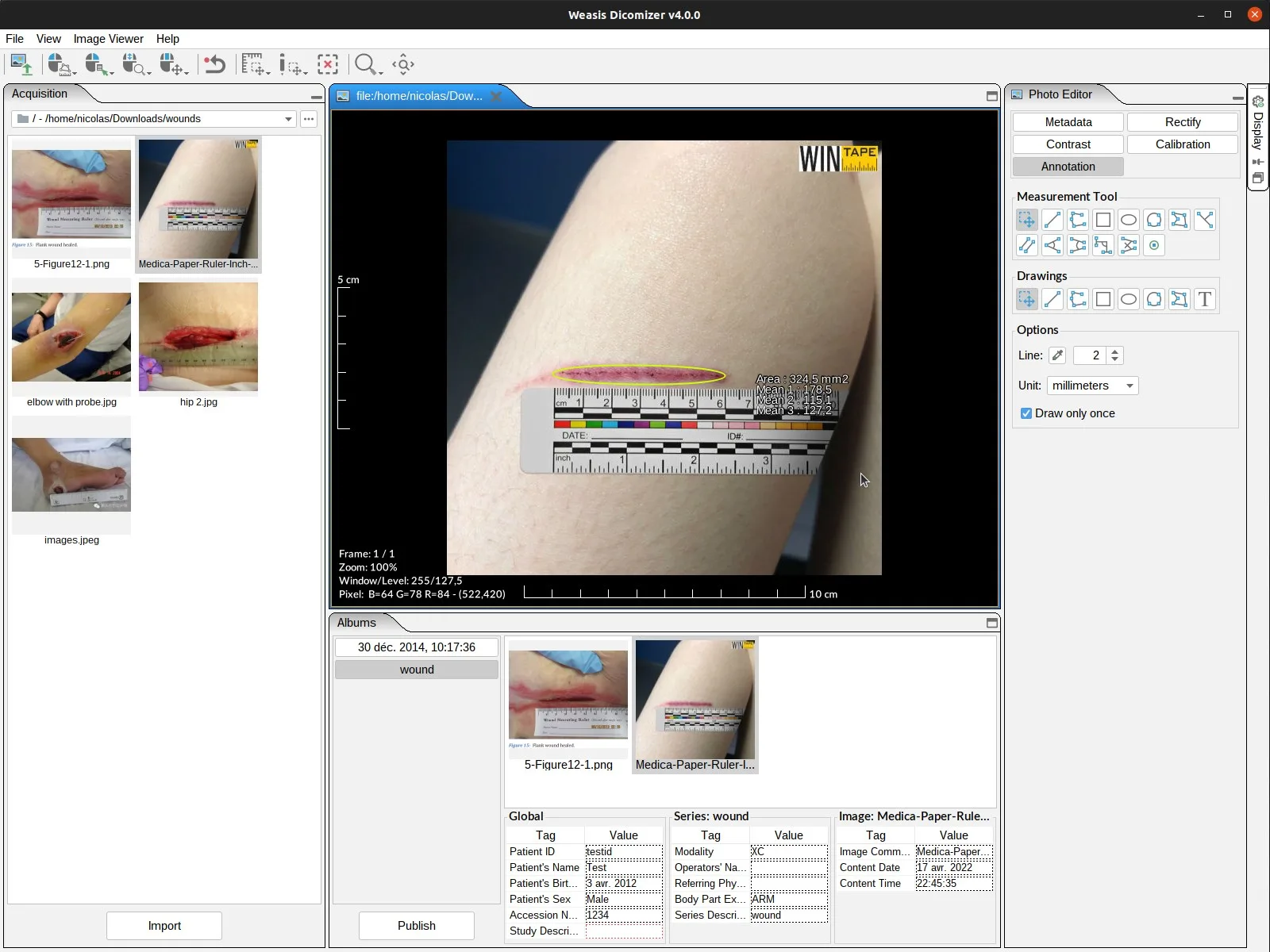 Weasis DICOM medical viewer screenshot 2