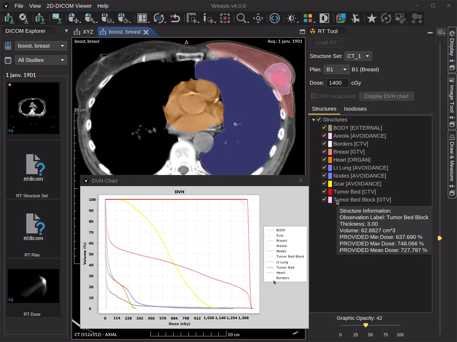 Weasis DICOM medical viewer screenshot 3
