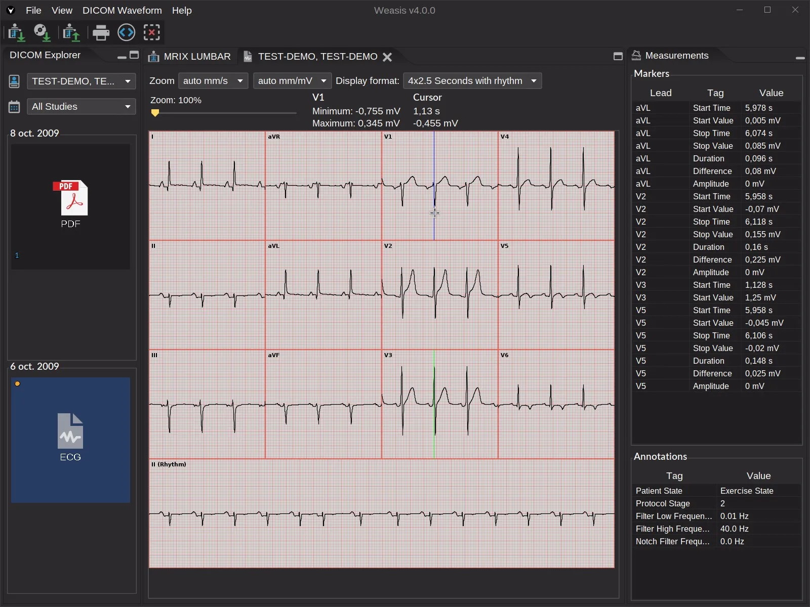 Weasis DICOM medical viewer screenshot 4