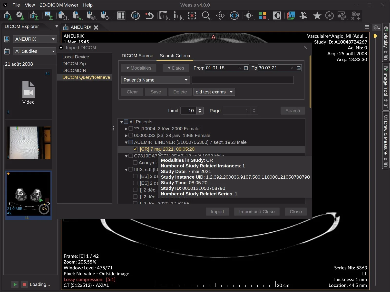 Weasis DICOM medical viewer screenshot 5