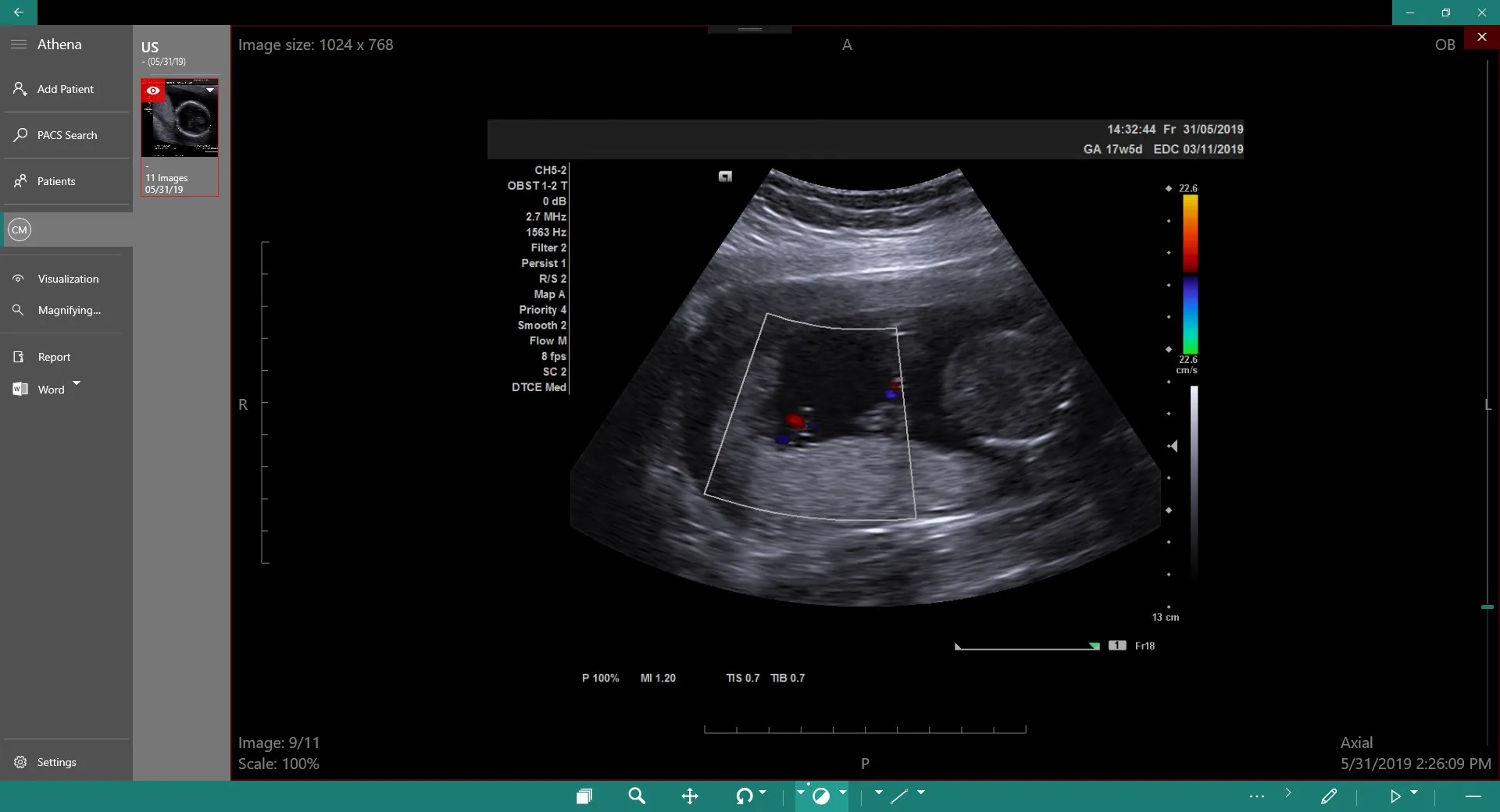 DICOM Viewer Essential screenshot 1
