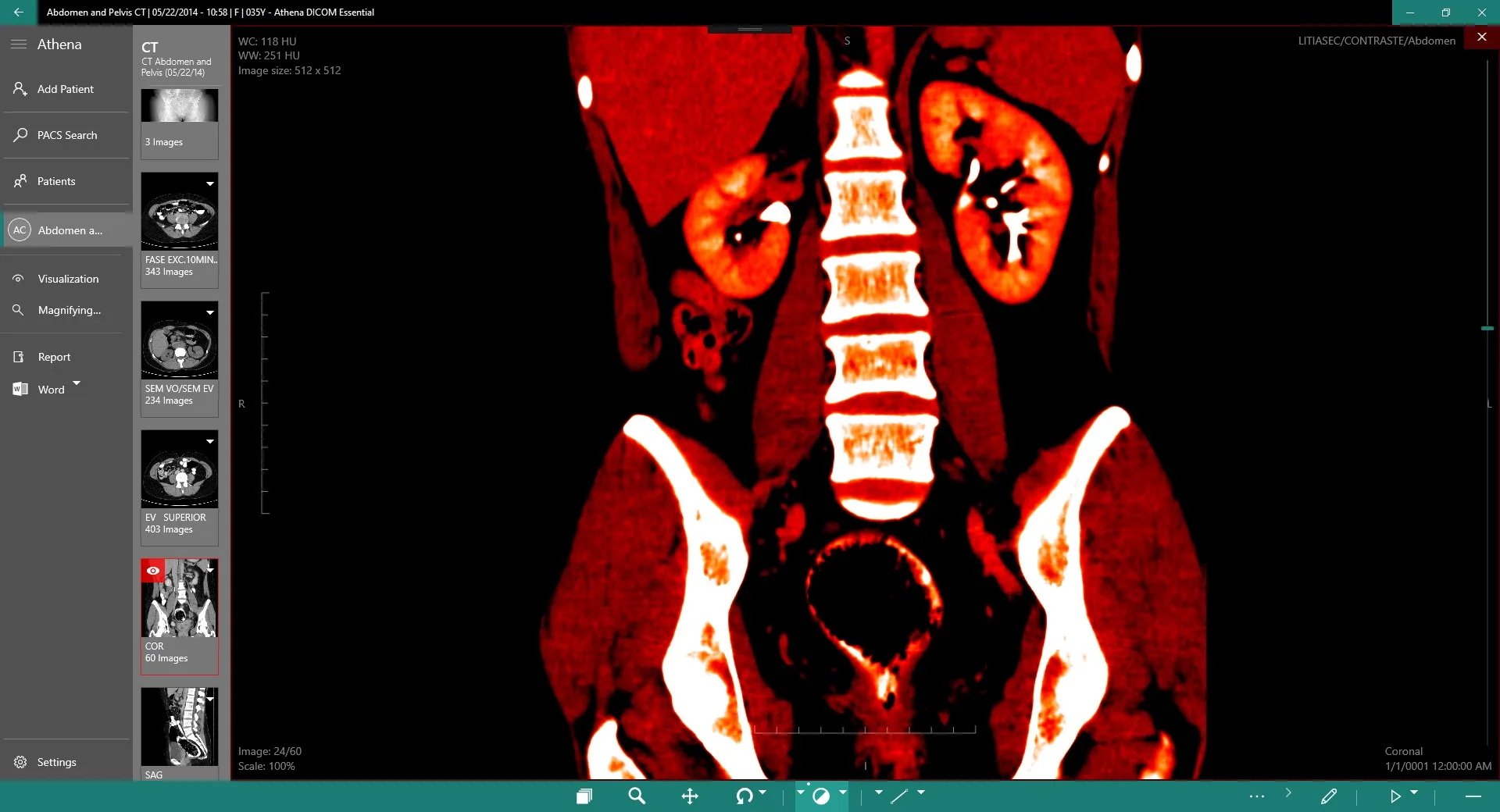 DICOM Viewer Essential screenshot 2
