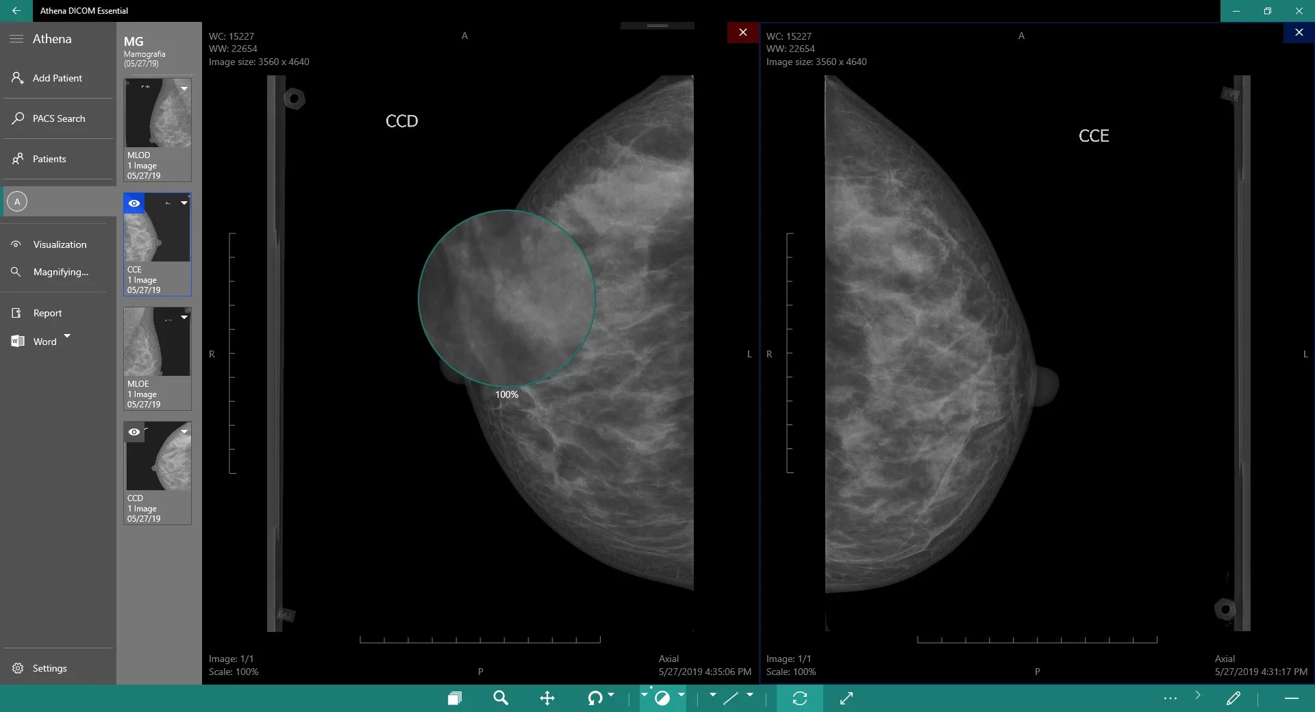 DICOM Viewer Essential screenshot 3