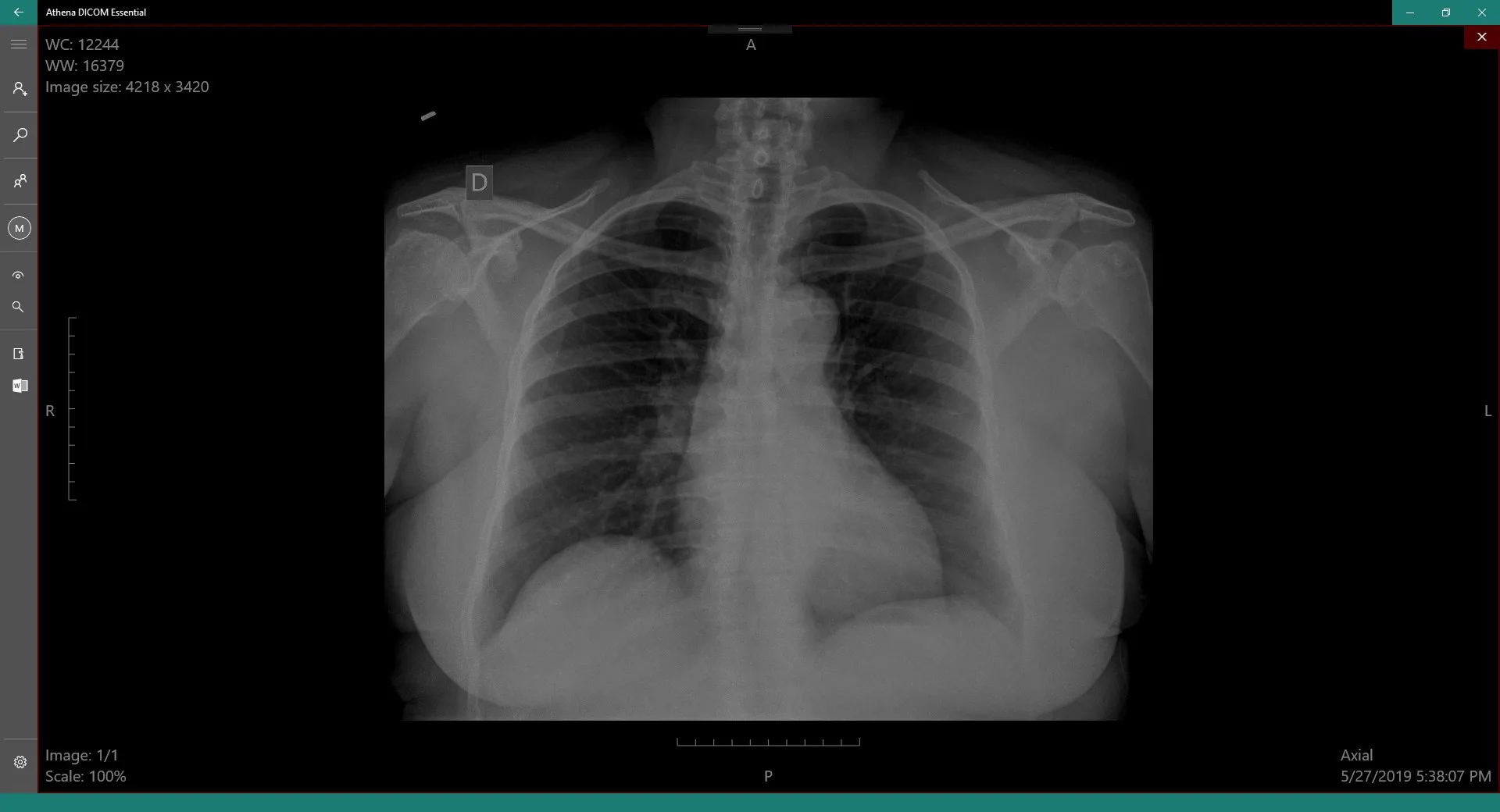 DICOM Viewer Essential screenshot 5